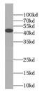 KISS1 Receptor antibody, FNab04593, FineTest, Western Blot image 