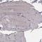 Protein Kinase C Zeta antibody, NBP1-87270, Novus Biologicals, Immunohistochemistry paraffin image 