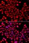 Retinoic Acid Receptor Gamma antibody, LS-C349149, Lifespan Biosciences, Immunofluorescence image 