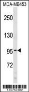 Collagen Type VI Alpha 2 Chain antibody, 58-453, ProSci, Western Blot image 