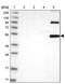 Tripartite Motif Containing 69 antibody, PA5-56006, Invitrogen Antibodies, Western Blot image 