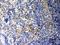 Galectin 3 antibody, LS-C357474, Lifespan Biosciences, Immunohistochemistry paraffin image 
