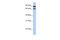 Cilia And Flagella Associated Protein 157 antibody, A18369, Boster Biological Technology, Western Blot image 