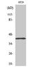 T-Box 10 antibody, STJ95930, St John