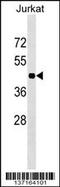 Homeobox C10 antibody, 59-289, ProSci, Western Blot image 