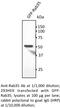 RAB35, Member RAS Oncogene Family antibody, AB0198-200, SICGEN, Western Blot image 