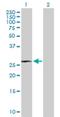 Rhox Homeobox Family Member 1 antibody, H00158800-B01P, Novus Biologicals, Western Blot image 