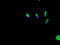 Hyaluronan Synthase 3 antibody, LS-C375874, Lifespan Biosciences, Immunofluorescence image 