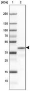 Proline Rich Transmembrane Protein 1 antibody, NBP2-30641, Novus Biologicals, Western Blot image 