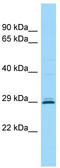 Cementum Protein 1 antibody, TA331200, Origene, Western Blot image 