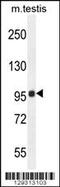 Transmembrane Protein 132E antibody, 55-873, ProSci, Western Blot image 