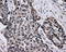 B-Raf Proto-Oncogene, Serine/Threonine Kinase antibody, LS-C114924, Lifespan Biosciences, Immunohistochemistry paraffin image 