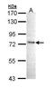 Inhibitor Of Nuclear Factor Kappa B Kinase Subunit Epsilon antibody, GTX111350, GeneTex, Western Blot image 