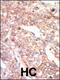 EPH Receptor A1 antibody, 63-036, ProSci, Immunohistochemistry paraffin image 