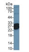 Troponin I1, Slow Skeletal Type antibody, LS-C296811, Lifespan Biosciences, Western Blot image 