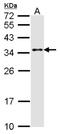 RNA polymerase transcriptional regulation mediator subunit 7 homolog antibody, NBP2-17258, Novus Biologicals, Western Blot image 