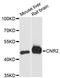 Cannabinoid Receptor 2 antibody, A1762, ABclonal Technology, Western Blot image 