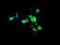 Cytidine/Uridine Monophosphate Kinase 1 antibody, NBP2-46313, Novus Biologicals, Immunofluorescence image 