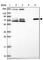 Zinc Finger Protein 510 antibody, HPA049139, Atlas Antibodies, Western Blot image 