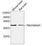 Serpin Family I Member 1 antibody, LS-C203183, Lifespan Biosciences, Western Blot image 