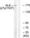 ALK Receptor Tyrosine Kinase antibody, PA5-38354, Invitrogen Antibodies, Western Blot image 
