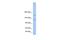 Bromodomain And PHD Finger Containing 3 antibody, A10721, Boster Biological Technology, Western Blot image 