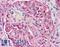 ATM Serine/Threonine Kinase antibody, LS-B1683, Lifespan Biosciences, Immunohistochemistry frozen image 