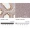 Katanin Regulatory Subunit B1 antibody, NBP1-87413, Novus Biologicals, Immunohistochemistry paraffin image 