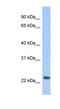 Mitochondrially Encoded NADH:Ubiquinone Oxidoreductase Core Subunit 6 antibody, NBP1-70650, Novus Biologicals, Western Blot image 