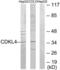 Cyclin Dependent Kinase Like 4 antibody, LS-C119097, Lifespan Biosciences, Western Blot image 