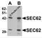 SEC62 Homolog, Preprotein Translocation Factor antibody, 6471, ProSci, Western Blot image 