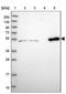 Coiled-Coil Domain Containing 149 antibody, NBP2-30476, Novus Biologicals, Western Blot image 
