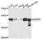 Glycogen Synthase Kinase 3 Alpha antibody, A0645, ABclonal Technology, Western Blot image 