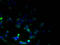 Transmembrane Protein 59 Like antibody, A61434-100, Epigentek, Immunofluorescence image 