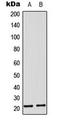 Mitochondrial Ribosomal Protein L11 antibody, LS-C354192, Lifespan Biosciences, Western Blot image 