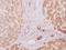 Protein Kinase C Substrate 80K-H antibody, PA5-21398, Invitrogen Antibodies, Immunohistochemistry paraffin image 