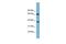 G Protein Nucleolar 3 antibody, GTX44808, GeneTex, Western Blot image 