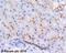 ATP Binding Cassette Subfamily B Member 1 antibody, ab3366, Abcam, Immunohistochemistry paraffin image 