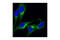 Clathrin Heavy Chain antibody, 2410S, Cell Signaling Technology, Immunocytochemistry image 