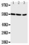 Cytochrome P450 Family 19 Subfamily A Member 1 antibody, PA2107, Boster Biological Technology, Western Blot image 