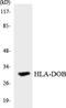 Major Histocompatibility Complex, Class II, DO Beta antibody, LS-C292055, Lifespan Biosciences, Western Blot image 