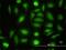 Aminopeptidase Like 1 antibody, H00079716-M01, Novus Biologicals, Immunofluorescence image 