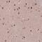 Nuclear Factor Of Activated T Cells 5 antibody, NBP2-49612, Novus Biologicals, Immunohistochemistry paraffin image 