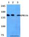Adhesion G Protein-Coupled Receptor F5 antibody, LS-C411924, Lifespan Biosciences, Western Blot image 