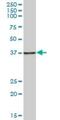 HSPA (Hsp70) Binding Protein 1 antibody, H00023640-B01P, Novus Biologicals, Western Blot image 