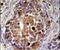 Retinol Dehydrogenase 16 antibody, PA5-25370, Invitrogen Antibodies, Immunohistochemistry paraffin image 