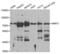 Matrix Metallopeptidase 2 antibody, abx004769, Abbexa, Western Blot image 