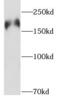 PH Domain And Leucine Rich Repeat Protein Phosphatase 1 antibody, FNab06398, FineTest, Western Blot image 