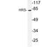 Hepatocyte Growth Factor-Regulated Tyrosine Kinase Substrate antibody, LS-C176533, Lifespan Biosciences, Western Blot image 
