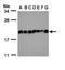 Eukaryotic Translation Initiation Factor 5A2 antibody, orb74027, Biorbyt, Western Blot image 